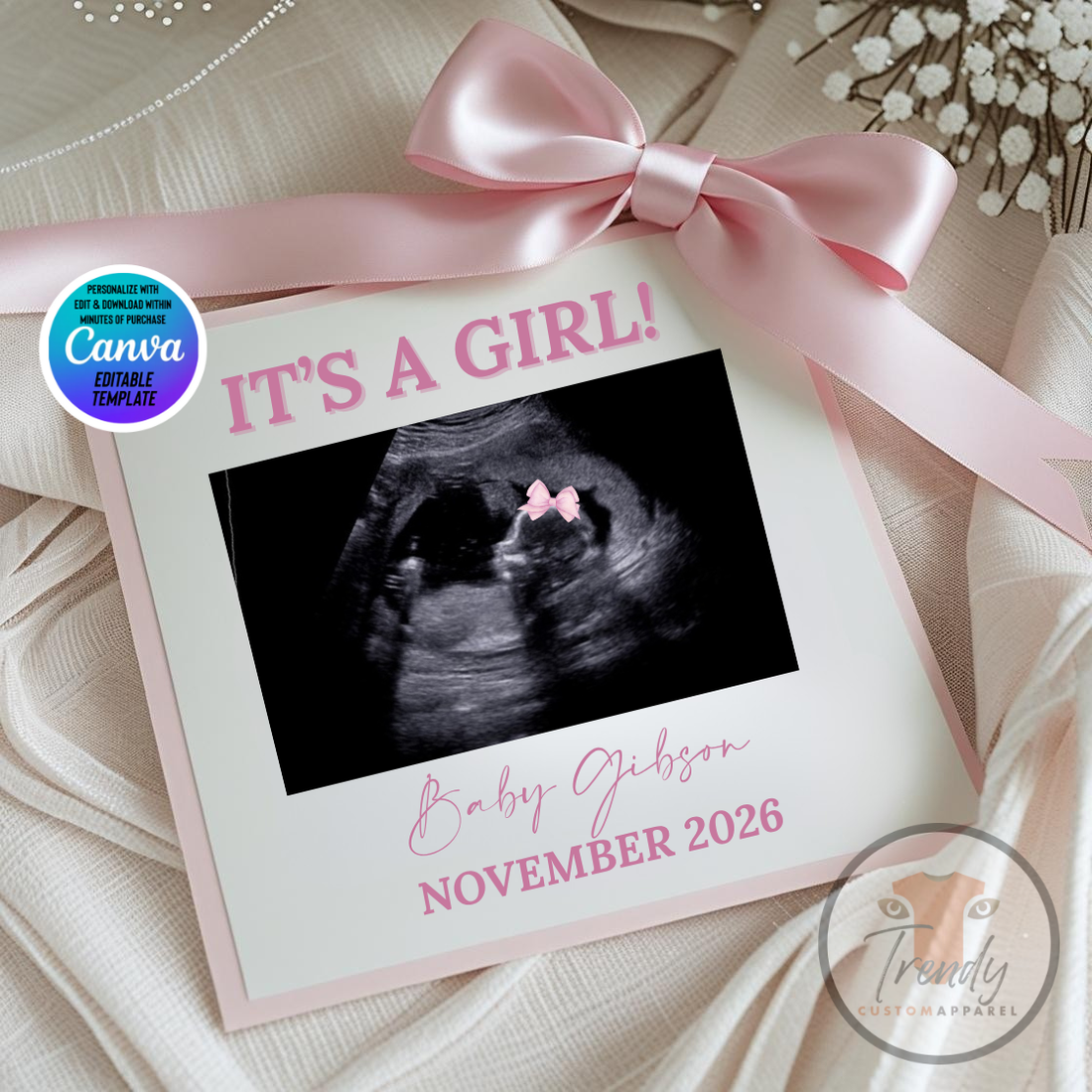 Gender Reveal Baby Girl card with ultrasound photo, 'It's a Girl!' text, and pink ribbon on a soft fabric background.